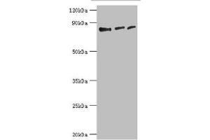 Western blot All lanes: Histone-lysine N-methyltransferase EZH1 antibody at 4 μg/mL Lane 1: Hela whole cell lysate Lane 2: HL60 whole cell lysate Lane 3: Mouse gonad tissue Secondary Goat polyclonal to rabbit IgG at 1/10000 dilution Predicted band size: 86, 87, 81, 77, 69 kDa Observed band size: 86 kDa