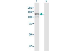Western Blot analysis of MAN2B1 expression in transfected 293T cell line by MAN2B1 MaxPab polyclonal antibody. (MAN2B1 anticorps  (AA 1-1011))