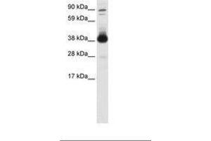 Image no. 1 for anti-Forkhead Box H1 (FOXH1) (AA 241-290) antibody (ABIN6736080) (FOXH1 anticorps  (AA 241-290))