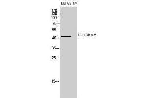 Western Blotting (WB) image for anti-Interleukin 13 Receptor, alpha 2 (IL13RA2) (Internal Region) antibody (ABIN6282532)