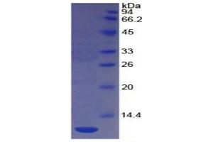 SDS-PAGE of Protein Standard from the Kit  (Highly purified E. (CD31 Kit ELISA)