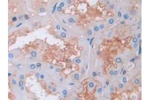 Detection of GAB1 in Human Kidney Tissue using Polyclonal Antibody to GRB2 Associated Binding Protein 1 (GAB1) (GAB1 anticorps  (AA 394-656))
