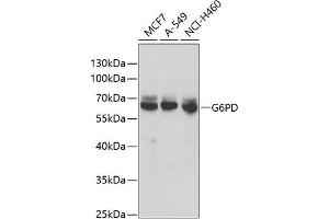 Western blot analysis of extracts of various cell lines, using G6PD antibody (ABIN6131014, ABIN6140863, ABIN6140864 and ABIN6218178) at 1:1000 dilution. (Glucose-6-Phosphate Dehydrogenase anticorps  (AA 246-545))