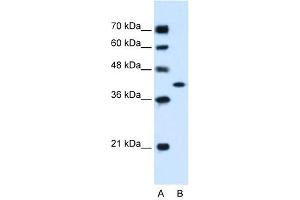 WB Suggested Anti-GOT2  Antibody Titration: 1. (GOT2 anticorps  (C-Term))