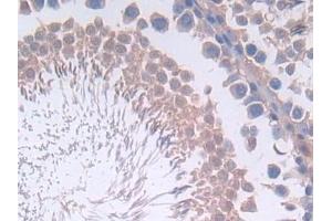 Detection of IL12A in Rat Testis Tissue using Polyclonal Antibody to Interleukin 12A (IL12A)