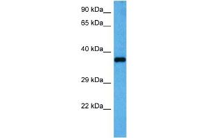 Host:  Rabbit  Target Name:  GAPDH  Sample Tissue:  Mouse Heart  Antibody Dilution:  1ug/ml (GAPDH anticorps  (Middle Region))