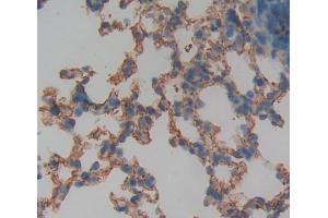 IHC-P analysis of lung tissue, with DAB staining. (Protein phosphatase 1 (AA 433-636), (Regulatory Subunit 15A) anticorps)