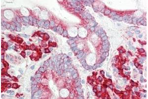 Human Small Intestine: Formalin-Fixed, Paraffin-Embedded (FFPE) (ETFA anticorps  (AA 276-304))