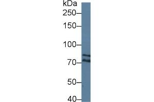 Detection of DICER1 in Human Jurkat cell lysate using Polyclonal Antibody to Dicer 1, Ribonuclease Type III (DICER1)