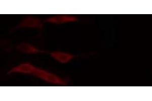 ABIN6274383 staining HuvEc cells by IF/ICC. (DGKD anticorps  (N-Term))