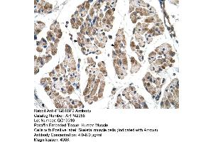 Rabbit Anti-ITGB1BP2 Antibody  Paraffin Embedded Tissue: Human Muscle Cellular Data: Skeletal muscle cells Antibody Concentration: 4. (ITGB1BP2 anticorps  (N-Term))