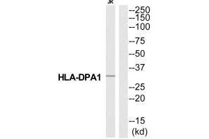Western blot analysis of extracts from Jurkat cells, using HA2Q antibody. (HLA-DPA1 anticorps  (N-Term))