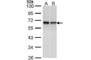 WB Image Sample (30 ug of whole cell lysate) A: A431 , B: Hela 10% SDS PAGE antibody diluted at 1:1000