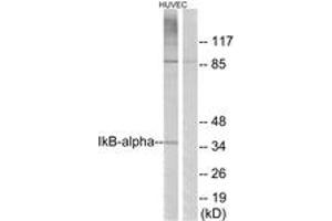 Western blot analysis of extracts from HuvEc cells, treated with TNF-alpha 20ng/ml 30', using IkappaB-alpha (Ab-42) Antibody. (NFKBIA anticorps  (AA 9-58))