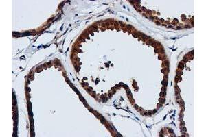 Immunohistochemical staining of paraffin-embedded Human breast tissue using anti-GATM mouse monoclonal antibody. (GATM anticorps)