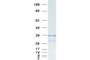 Validation with Western Blot