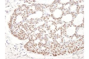anti-B-Cell CLL/lymphoma 11B (Zinc Finger Protein) (BCL11B) (C-Term) antibody