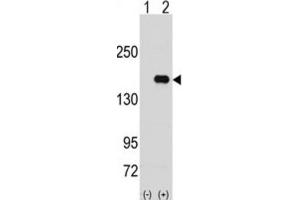 Western Blotting (WB) image for anti-Pumilio Homolog 2 (Drosophila) (PUM2) antibody (ABIN3003295) (PUM2 anticorps)