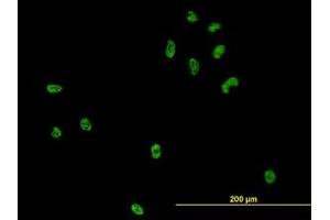 Image no. 2 for anti-CSE1 Chromosome Segregation 1-Like (CSE1L) (AA 872-972) antibody (ABIN465994) (Exportin 2 anticorps  (AA 872-972))