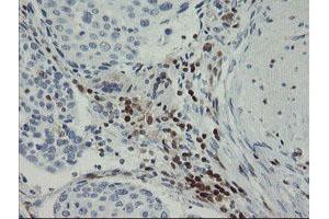 Image no. 11 for anti-GTPase, IMAP Family Member 4 (GIMAP4) antibody (ABIN1498460)