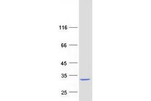 Validation with Western Blot