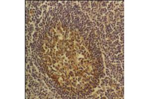 CD54 – ABIN118785 - Tonsil. (ICAM1 anticorps)