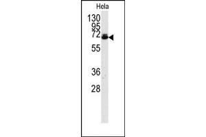 Image no. 1 for anti-Ubiquilin 2 (UBQLN2) (AA 28-57), (N-Term) antibody (ABIN357609)