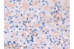 Detection of MYL3 in Mouse Kidney Tissue using Polyclonal Antibody to Myosin Light Chain 3, Alkali, Ventricular, Slow Skeletal (MYL3) (MYL3/CMLC1 anticorps  (AA 8-199))