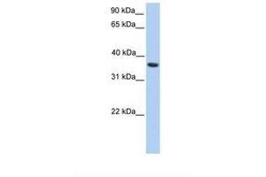 Image no. 1 for anti-Melanoma Antigen Family A, 4 (MAGEA4) (C-Term) antibody (ABIN6738943) (MAGEA4 anticorps  (C-Term))