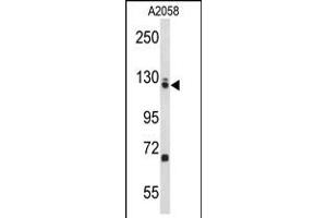 Western blot analysis of EFTUD2 Antibody in A2058 cell line lysates (35ug/lane)