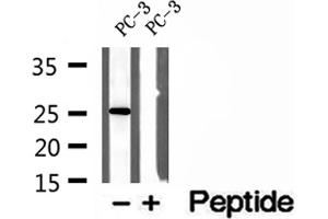 Western blot analysis of extracts of PC-3 cells, using OIP5 antibody. (OIP5 anticorps  (C-Term))