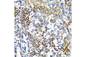 Immunohistochemistry of paraffin-embedded human tonsil using NFKB1 antibody (ABIN5998332) at dilution of 1/100 (40x lens). (NFKB1 anticorps)