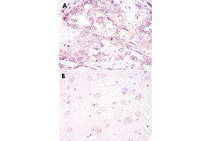 Immunohistochemical analysis of paraffin-embedded human ovarian cancer (A) and brain tissue (B) using PRKAA1 monoclonal antobody, clone 2B7  with DAB staining.
