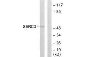 Western Blotting (WB) image for anti-Serine Incorporator 3 (SERINC3) (AA 361-410) antibody (ABIN2889579) (SERINC3 anticorps  (AA 361-410))