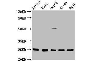 Western Blot Positive WB detected in: Jurkat whole cell lysate, Hela whole cell lysate, HepG2 whole cell lysate, HL60 whole cell lysate, Raji whole cell lysate All lanes: HMGB1 antibody at 1:2500 Secondary Goat polyclonal to rabbit IgG at 1/50000 dilution Predicted band size: 25 kDa Observed band size: 25 kDa (HMGB1 anticorps  (AA 8-179))
