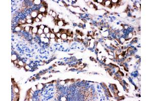 Anti-HSD17B2 antibody,  IHC(P) IHC(P): Rat Intestine Tissue (HSD17B2 anticorps  (C-Term))