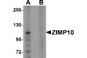 Western blot analysis of ZIMP10 in K562 cell lysate with ZIMP10 antibody at 0. (ZMIZ1 anticorps  (N-Term))