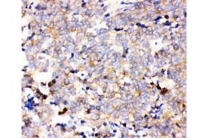 IHC analysis of IKKA using anti-IKKA antibody (ABIN3043812). (IKK alpha anticorps  (AA 411-745))