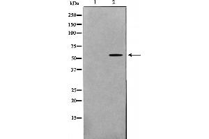 Western blot analysis on HeLa cell lysate using GK2 Antibody，The lane on the left is treated with the antigen-specific peptide. (GK2 anticorps  (Internal Region))