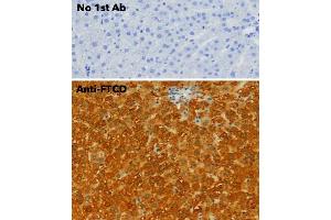 Immunohistochemistry (IHC) image for anti-Formiminotransferase Cyclodeaminase (FTCD) (N-Term) antibody (ABIN6254252)