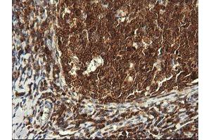 Image no. 3 for anti-Phosphoinositide-3-Kinase, Catalytic, gamma Polypeptide (PIK3CG) antibody (ABIN1500202)