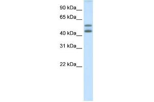 WB Suggested Anti-IRF5 Antibody Titration:  0. (IRF5 anticorps  (N-Term))