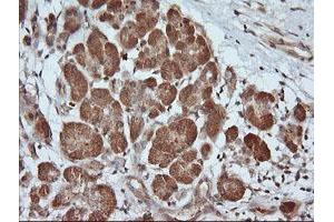 Image no. 2 for anti-Parvin, alpha (PARVA) antibody (ABIN1496444)