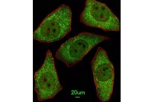 Immunofluorescent analysis of A549 cells, using MSRA Antibody (N-term) (ABIN391489 and ABIN2841456).