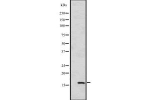 Western blot analysis of HSPB9 expression in A549 cell line lysates ,The lane on the left is treated with the antigen-specific peptide. (HSPB9 anticorps  (C-Term))