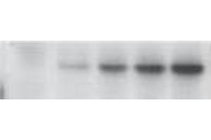 Western Blotting (WB) image for anti-Tumor Protein P53 (TP53) (pSer46) antibody (ABIN3201005) (p53 anticorps  (pSer46))