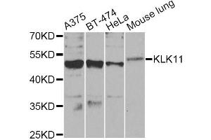 Western blot analysis of extracts of various cell lines, using KLK11 Antibody. (Kallikrein 11 anticorps)
