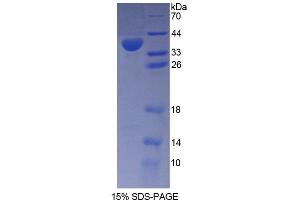 SDS-PAGE analysis of Human PMM1 Protein.