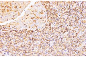 Immunohistochemistry of paraffin-embedded Human tonsil using Anxa6 Polyclonal Antibody at dilution of 1:100