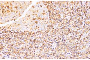 Immunohistochemistry of paraffin-embedded Human tonsil using Anxa6 Polyclonal Antibody at dilution of 1:100 (ANXA6 anticorps)